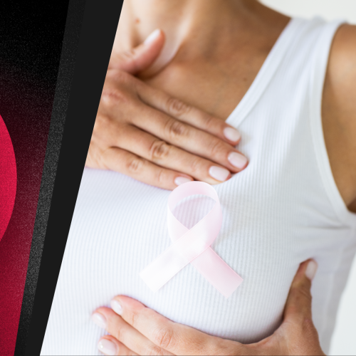 360 Seminar: Ενημέρωση για την  πρόληψη κατά του καρκίνου του μαστού